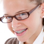 smiling girl with colored braces